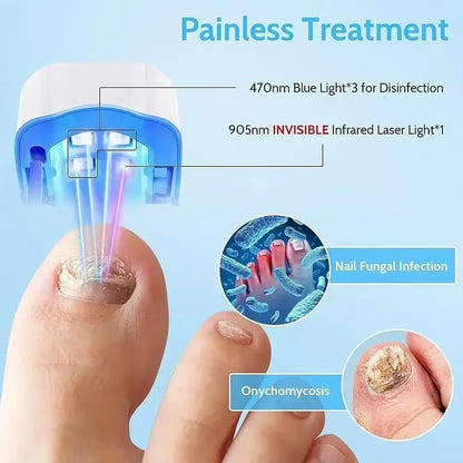 Nail Fungus Laser Treatment Device Repair Toenail Fingernail Fungus Treat Onychomycosis Therapy Cure Machine Effectively Remove - Bavaro Shop