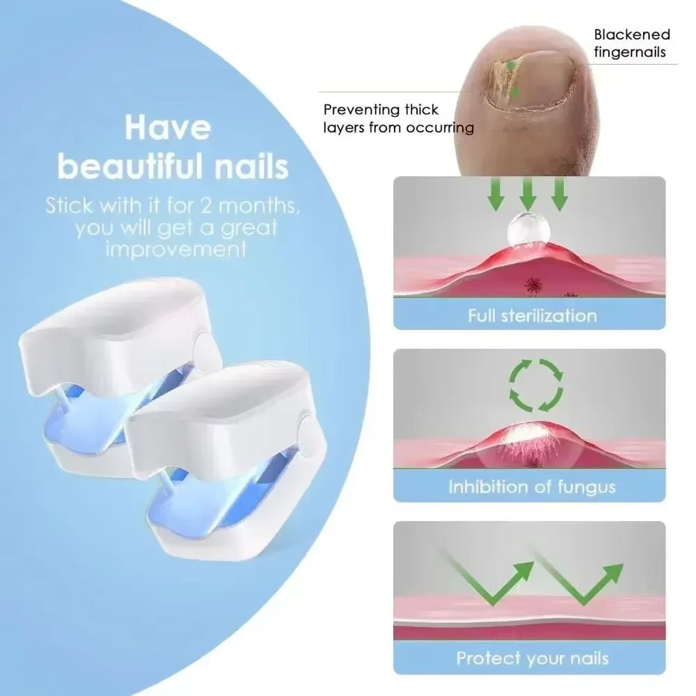 Nail Fungus Laser Treatment Device Repair Toenail Fingernail Fungus Treat Onychomycosis Therapy Cure Machine Effectively Remove - Bavaro Shop